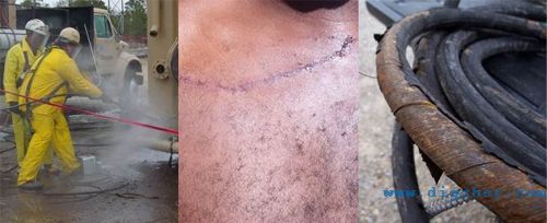 高壓清洗機(jī)工作中應(yīng)注意的安全問(wèn)題